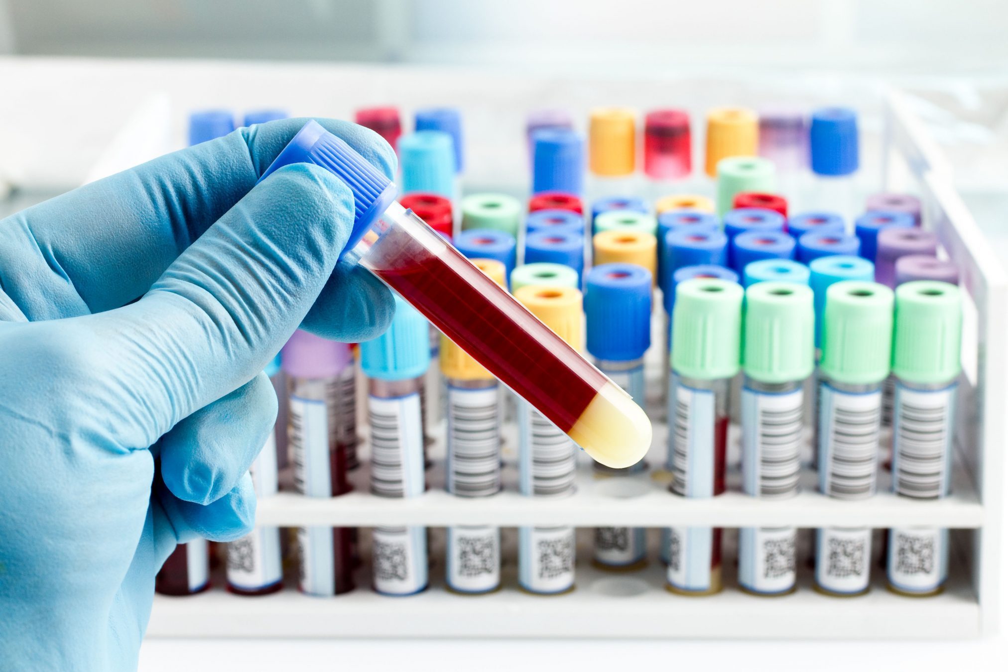 How to sell your pathology technology in the new COVID normal